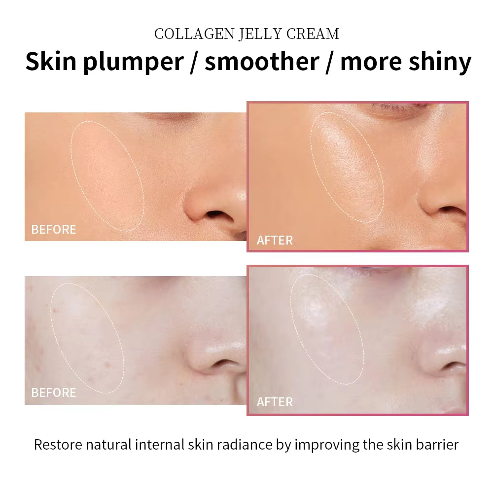 Collagen Jelly Cream Niacinamide Tightening Soothing Moisturizing Anti-Aging Firmness Hydratio...