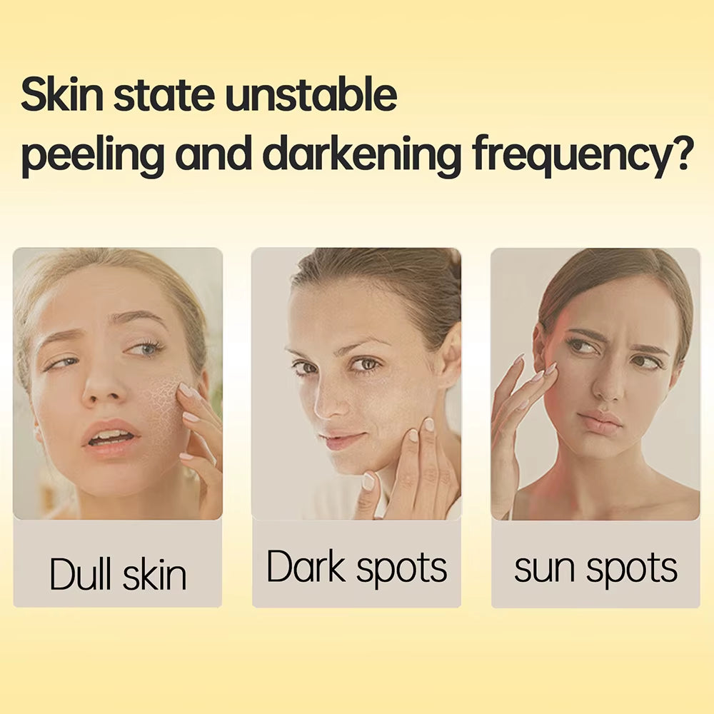 Kojic Acid Retinol Cream Skin Whitening Cream Remove Dark Spots anti Aging Brighten Moisturizer