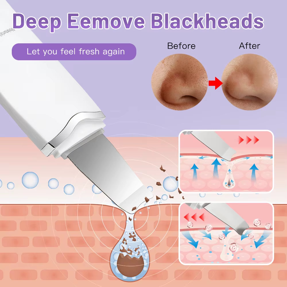 Electric Skin Scrubber Peeling Blackhead Remover Deep Face Cleaning Facial Lifting Acne Cleaner 