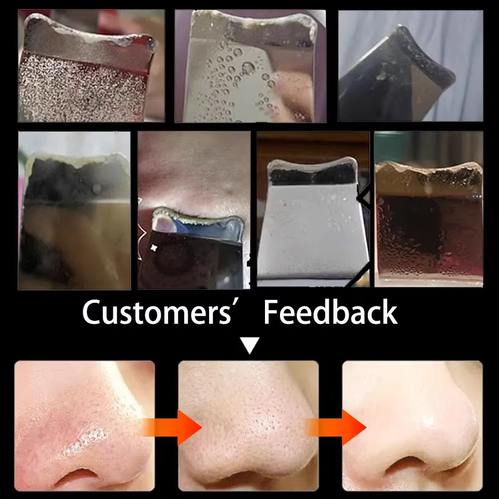Electric Skin Scrubber Peeling Blackhead Remover Deep Face Cleaning Facial Lifting Acne Cleaner 