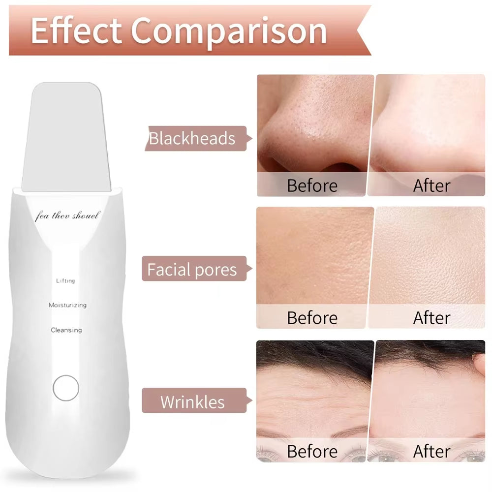 Electric Skin Scrubber Peeling Blackhead Remover Deep Face Cleaning Facial Lifting Acne Cleaner 