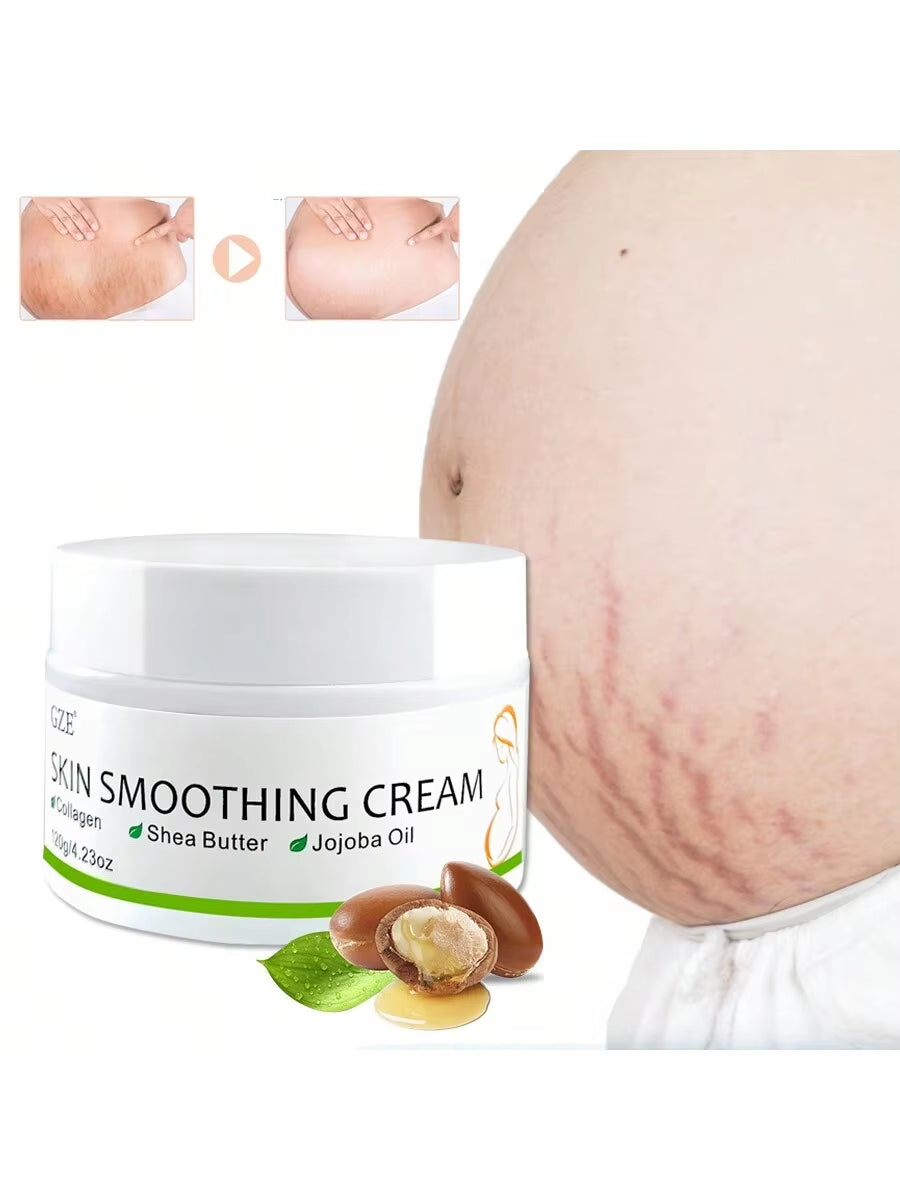 Skin Smoothing Cream with Cocoa Butter & Olive to Lighten Postpartum Obesity Marks